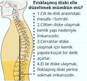 Bel Fıtığı Elle Yerleştirme